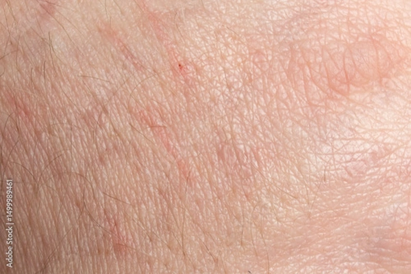 Obraz light caucasian skin texture macro