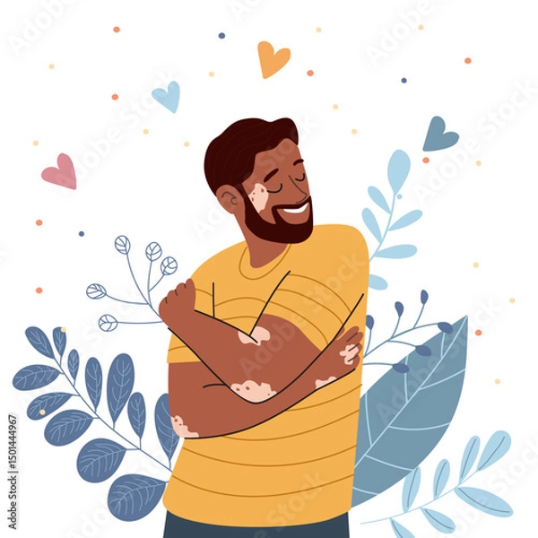 Fototapeta Man hugging himself with vitiligo embracing body positivity. Concept of mental health self care and unconditional love.