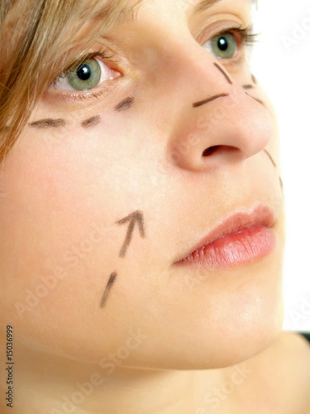 Obraz Facial plastic surgery