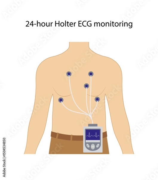 Obraz 24-hour Holter ECG monitoring. Electrocardiogram. Heart cardiogram. Vector illustration in flat style isolated on white background