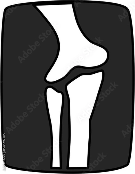 Obraz Illustration of an elbow joint x-ray