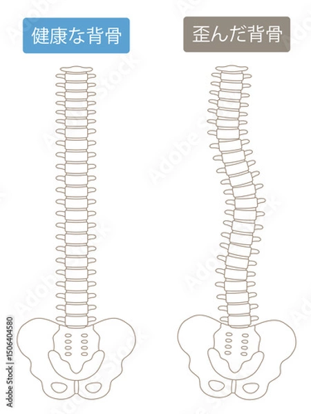 Obraz 歪んだ背骨と健康な背骨