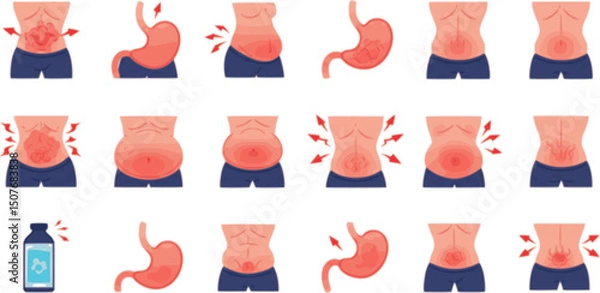 Obraz vector set of Bloating icons set. People experiencing digestive problems, discomfort, and symptoms related to stomach and gut health
