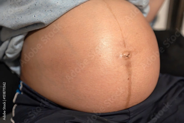Fototapeta Close-Up of Pregnant Belly Highlighting the Linea Nigra and Belly Button