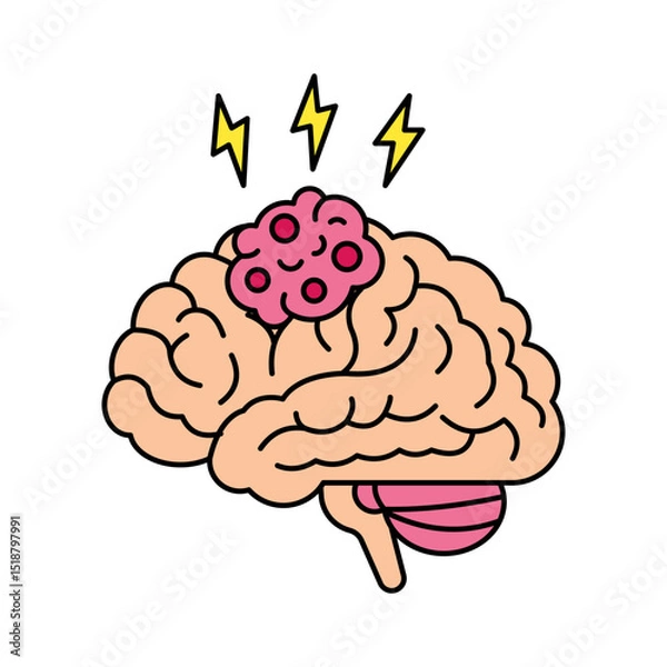 Obraz Brain Tumor disease illustration
