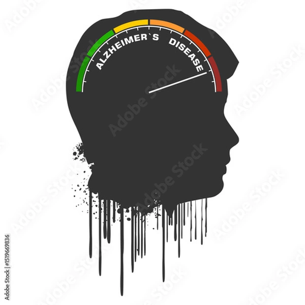 Fototapeta Dementia, memory loss, amnesia concept. Brain damage, cognitive disfunction. Alzheimer's disease. Illustration of a human head profile with abstract device scale. Mental, psychological illness