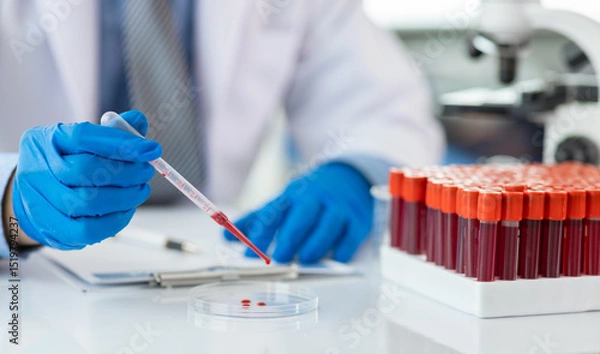 Fototapeta Scientist analyzing blood sample in modern laboratory. Scientist wearing gloves is using a pipette to analyze a blood sample in a petri dish.
