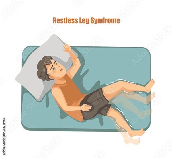 Fototapeta Restless Leg Syndrome Illustration of Sleepless Man Sweating in Bed