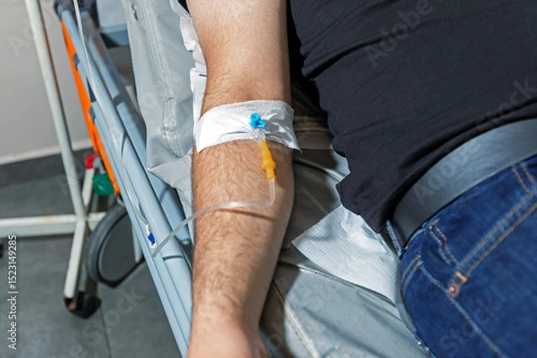 Obraz A man arm with an IV drip. An IV catheter in a man's arm. Intravenous administration of drugs using an infusion system.