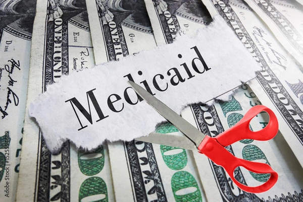 Obraz Medicaid newspaper headline on cash with scissors about to cut
