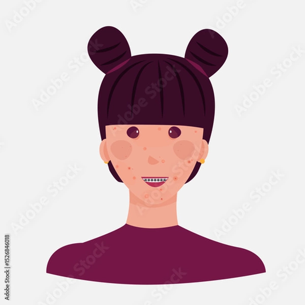 Obraz Teen girl avatar with acne and pimples smiling. The girl has dark hair and braces. Universal image. Vector graphics.