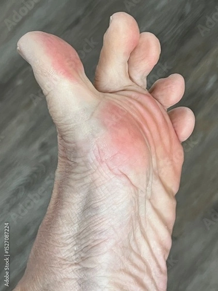 Fototapeta Closeup of playful toes with pink pads