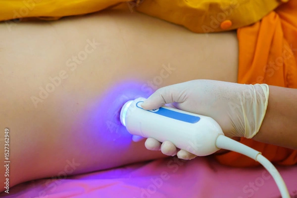 Fototapeta Closeup of man getting an fibroscan or ultrasound scan on abdominal by doctor of the liver revealed for liver stiffness, liver steatosis, fibrosis reading. Ultrasound elastography