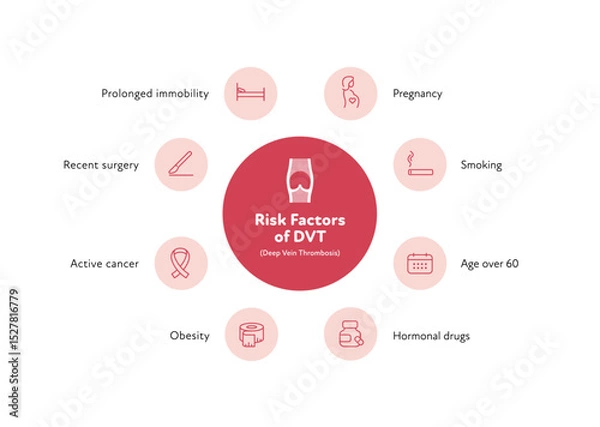 Obraz Deep vein thrombosis for healthcare infographic. Vector outline icon set illustration. Risk factor of DVT. Blood vessel with thromb symbol. Design for health care, education