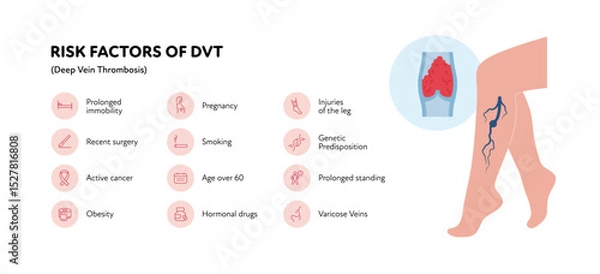 Obraz Deep vein thrombosis for healthcare infographic. Vector outline icon set illustration. Risk factor of DVT. Woman leg with thromb in blood vessel symbol. Design for health care, education