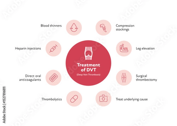 Obraz Deep vein thrombosis for healthcare infographic. Vector outline icon set illustration. Treatment of DVT. Blood vessel with thromb symbol. Design for health care, education