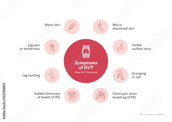 Obraz Deep vein thrombosis for healthcare infographic. Vector outline icon set illustration. Risk factor of DVT. Blood vessel with thromb symbol. Design for health care, education