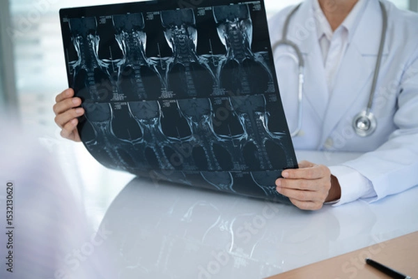 Obraz Orthopedist checkup cervical spine x-ray film and diagnose cervical spondylosis at doctor room.