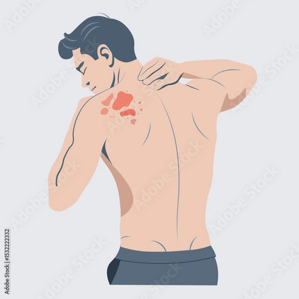 Obraz Autoimmune progesterone dermatitis,urticaria,Bullous pemphigoid,herpetiformis,Dermatomyositis,Epidermolysis bullosa acquisita,Gestational,Hidradenitis suppurativa,Lichen planus,Linear IgA,Psoriasis