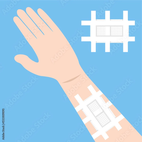 Obraz Patient’s arm wrapped in gauze pad,
secured using white adhesive tape,
for wound treatment and first aid,
doctor care, flat design style.