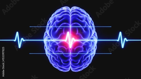 Fototapeta Scientific illustration of neuroinflammation and brain malfunction with disrupted electric activity and EEG spike patterns