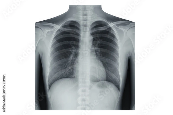 Fototapeta Radiographic image of healthy human thorax, showing lungs, heart, ribs, and bones, isolated on transparent background