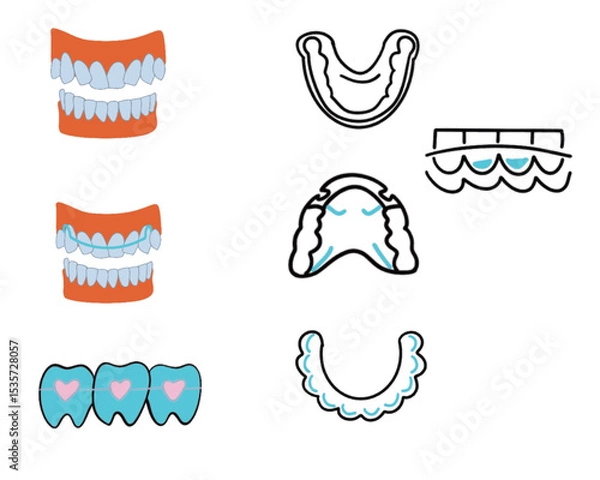 Obraz vector illustration.hawley retainer before and after