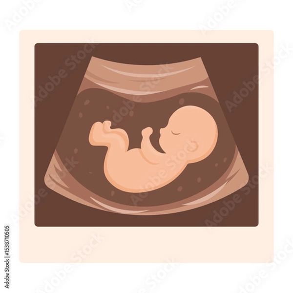 Obraz Vector cartoon image of ultrasound scan with baby. Pregnancy management concept. Element for your design