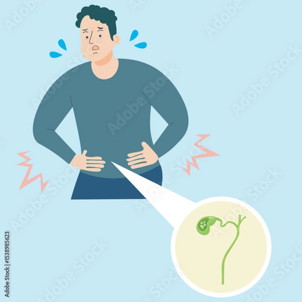 Obraz Flat vector illustration showing acute cholecystitis and related gallbladder diseases like gallstones and biliary colic, highlighting inflammation, pain, and digestive distress medical context 