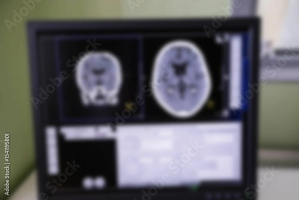 Obraz Digital brain scan on computer monitor