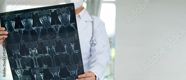 Fototapeta Orthopedist checkup cervical spine x-ray film and diagnose cervical spondylosis at doctor room with copy spacewide view.