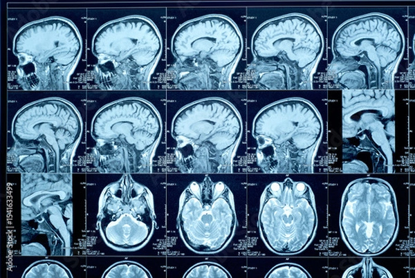 Obraz Closeup of a CT scan with brain. Magnetic resonance imaging. Medical, science and education mri brain background. Magnetic resonance imaging.