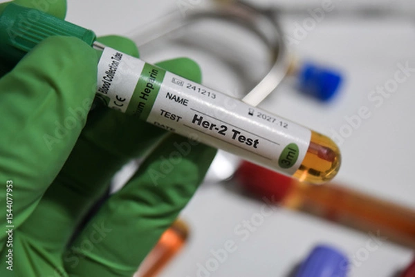 Obraz Her-2 - Test with blood sample. Top view isolated on office desk. Healthcare or Medical concept