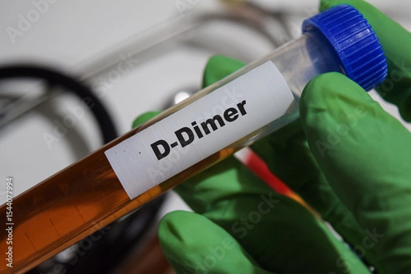 Obraz D-Dimer - Test with blood sample. Top view isolated on office desk. Healthcare or Medical concept