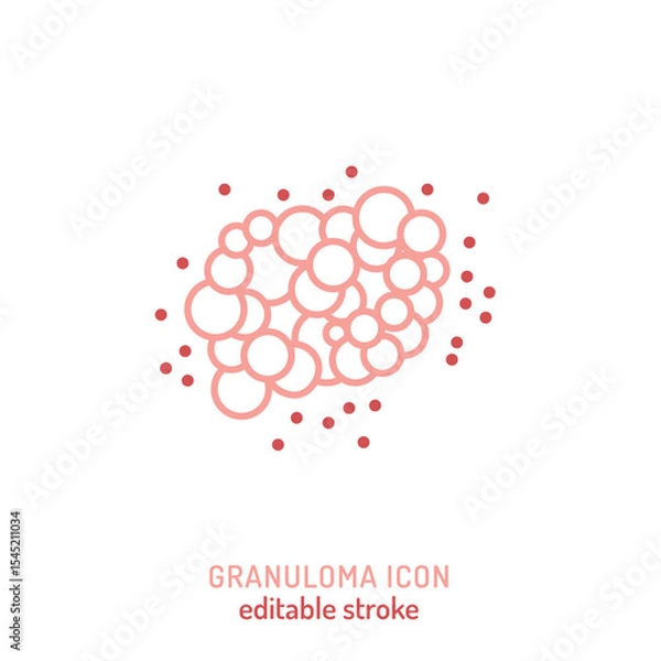 Fototapeta Granuloma icon. Editable vector illustration of clustered immune cell inflammation.