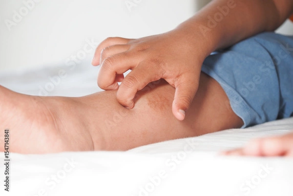 Fototapeta Child scratching an itchy leg in a bright room
