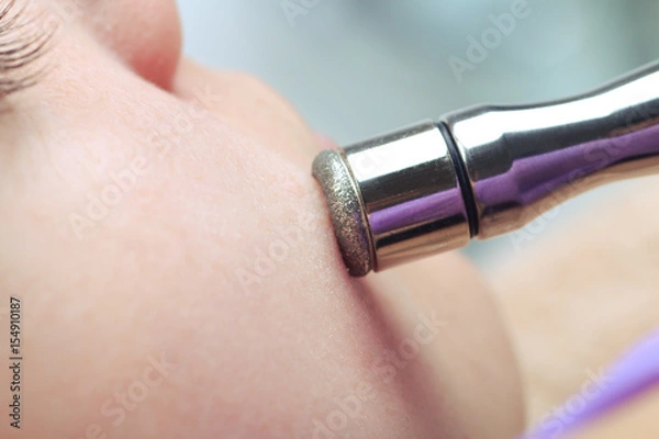 Fototapeta Diamond microdermabrasion, peeling cosmetic. woman during a microdermabrasion treatment in beauty salon