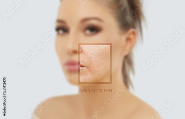 Obraz Signs of skin aging,signs of premature aging, Wrinkles and fine lines,Age spots,Sagging skin,Dehydrated skin,eyelid area