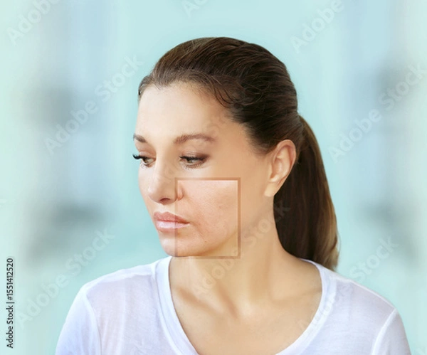 Obraz Signs of skin aging,signs of premature aging, Wrinkles and fine lines,Age spots,Sagging skin,Dehydrated skin,eyelid area