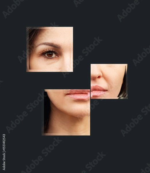 Obraz Signs of skin aging,signs of premature aging, Wrinkles and fine lines,Age spots,Sagging skin,Dehydrated skin,eyelid area