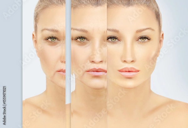 Obraz Signs of skin aging,signs of premature aging, Wrinkles and fine lines,Age spots,Sagging skin,Dehydrated skin,eyelid area