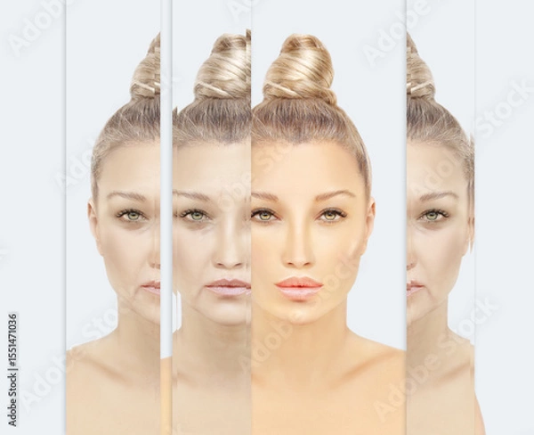 Obraz Signs of skin aging,signs of premature aging, Wrinkles and fine lines,Age spots,Sagging skin,Dehydrated skin,eyelid area