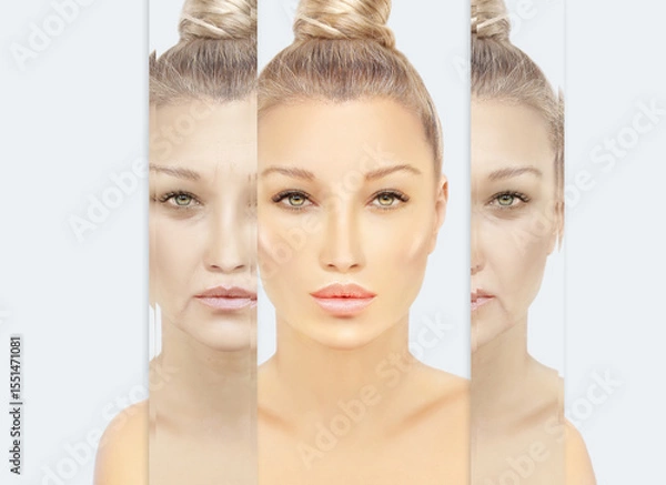 Obraz Signs of skin aging,signs of premature aging, Wrinkles and fine lines,Age spots,Sagging skin,Dehydrated skin,eyelid area