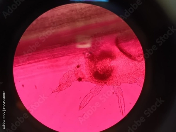 Obraz thrip under a microscope