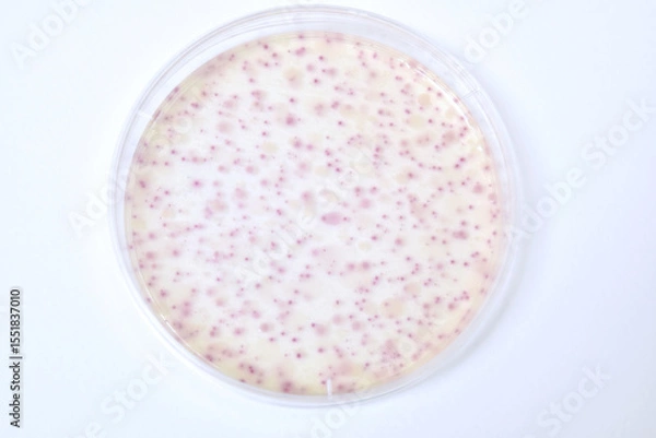 Obraz Colonies of bacteria growth on agar plate medium in laboratory.	