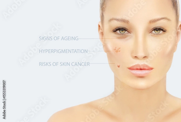 Obraz effects of sun exposure on facial skin