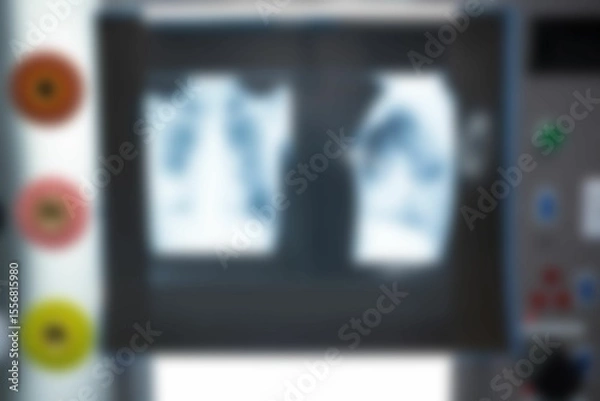 Obraz Blurry view of x-ray report in hospital