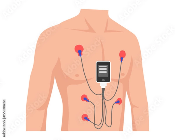 Obraz Man Wear Test Holter Monitor portable device tool, Heart's electrical activity (ECG) record, for detection irregular heartbeats (arrhythmias), with man, cable, pad, sensor, data. vector illustration