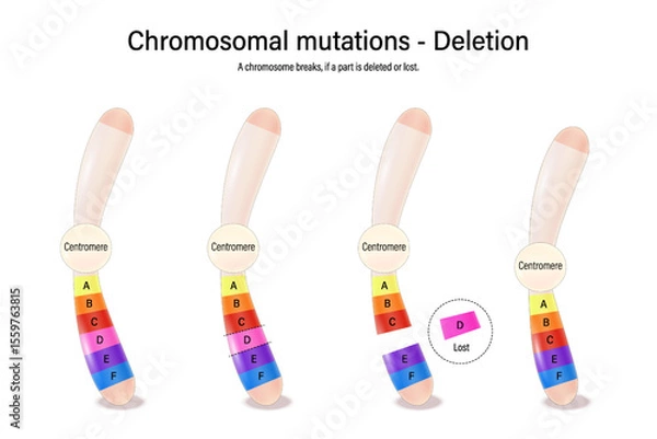 Fototapeta A chromosomal deletion. Chromosomal mutations. Various genetic disorders. Alteration of chromosome structure. Vector used for scientific and medical education. 