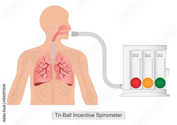 Obraz Tri ball incentive spirometer with human Lungs.